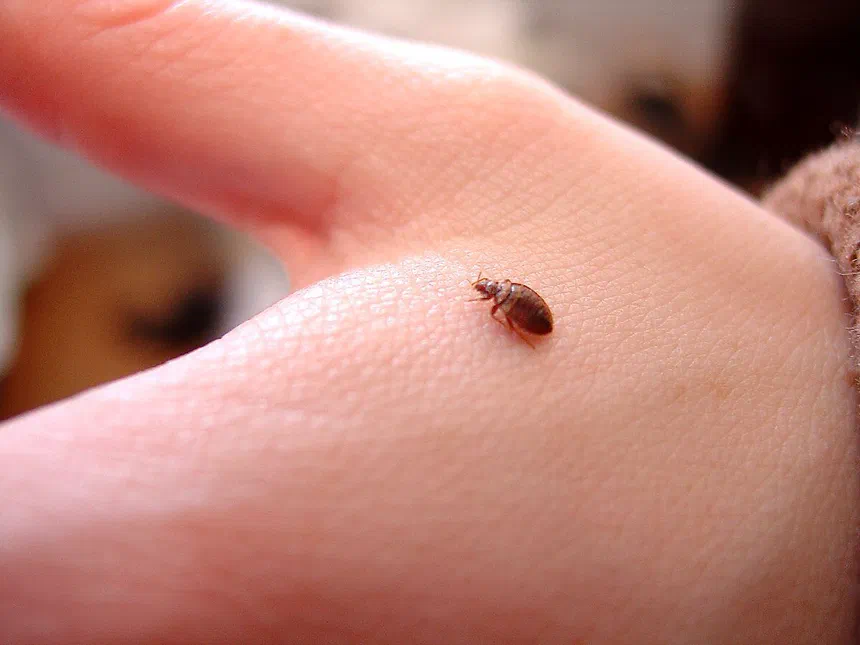 Bed Bug Bite Symptoms