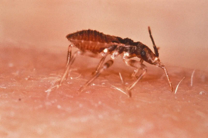 Kissing Bug Facts & Information