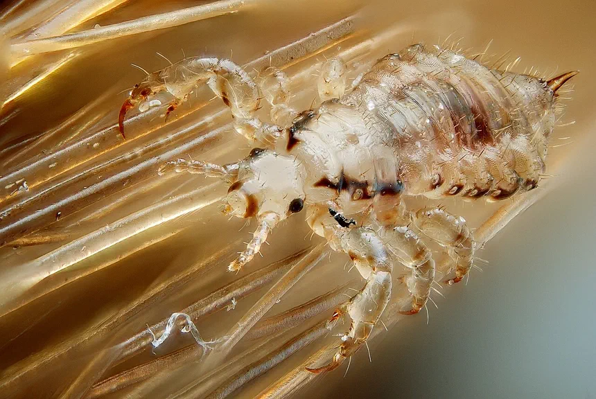 Lice