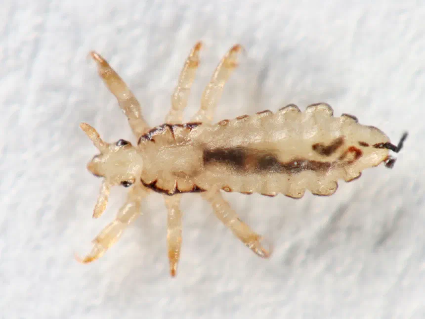 Human Lice Various