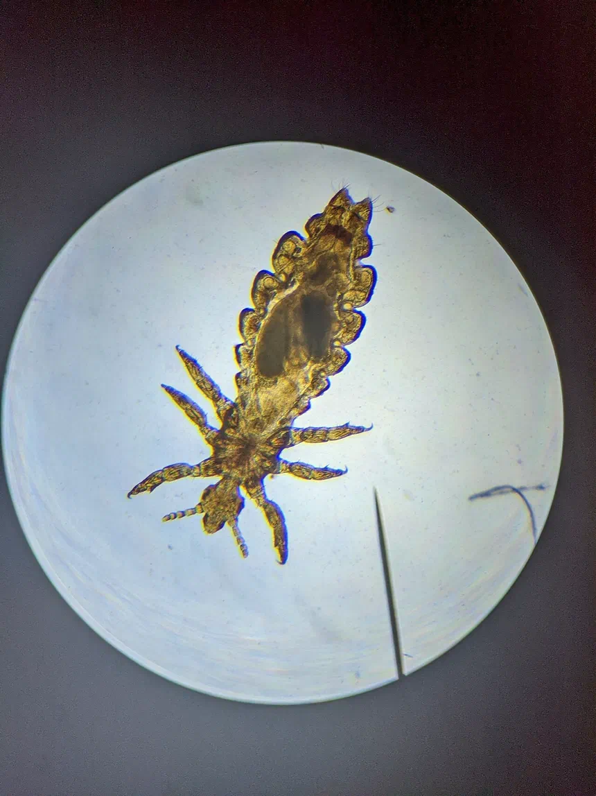 Human Lice