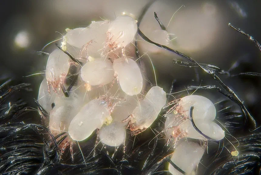 Dust Mite Facts & Information