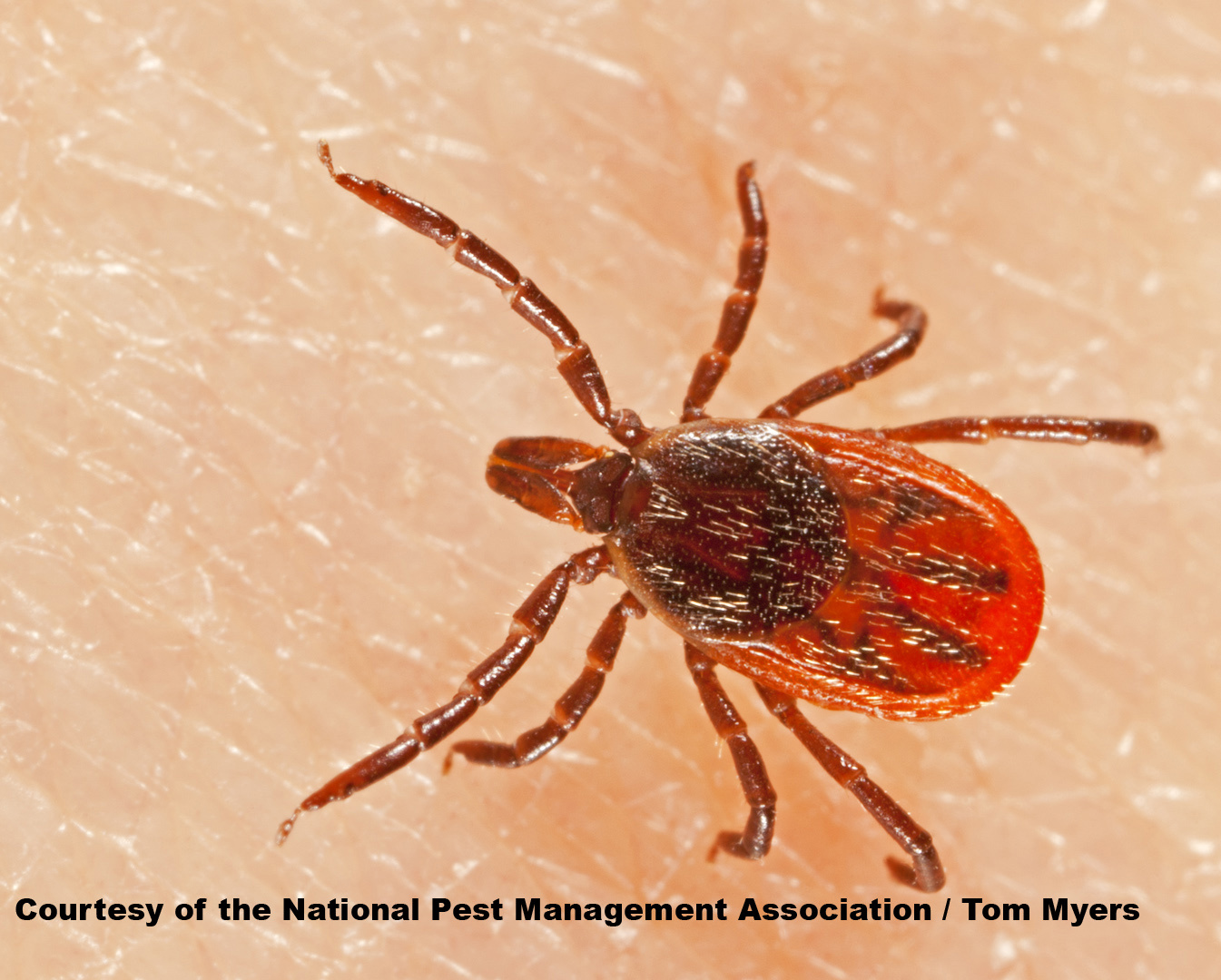 Blacklegged (Deer) Ticks