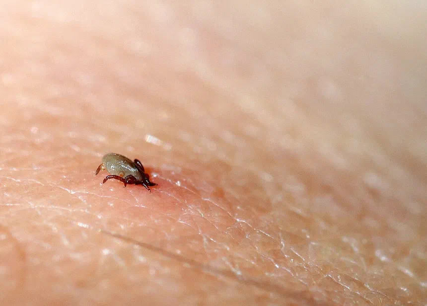 Tick Bites
